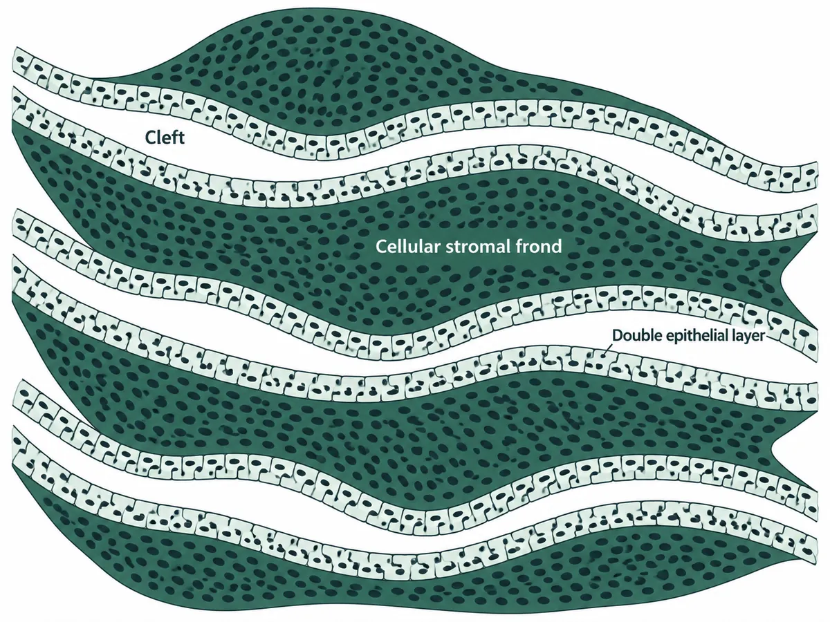 A low-power histological field showing elongated clefts lined by a double layer of epithelium, into which fronds of densely cellular stroma project like the leaves of a book