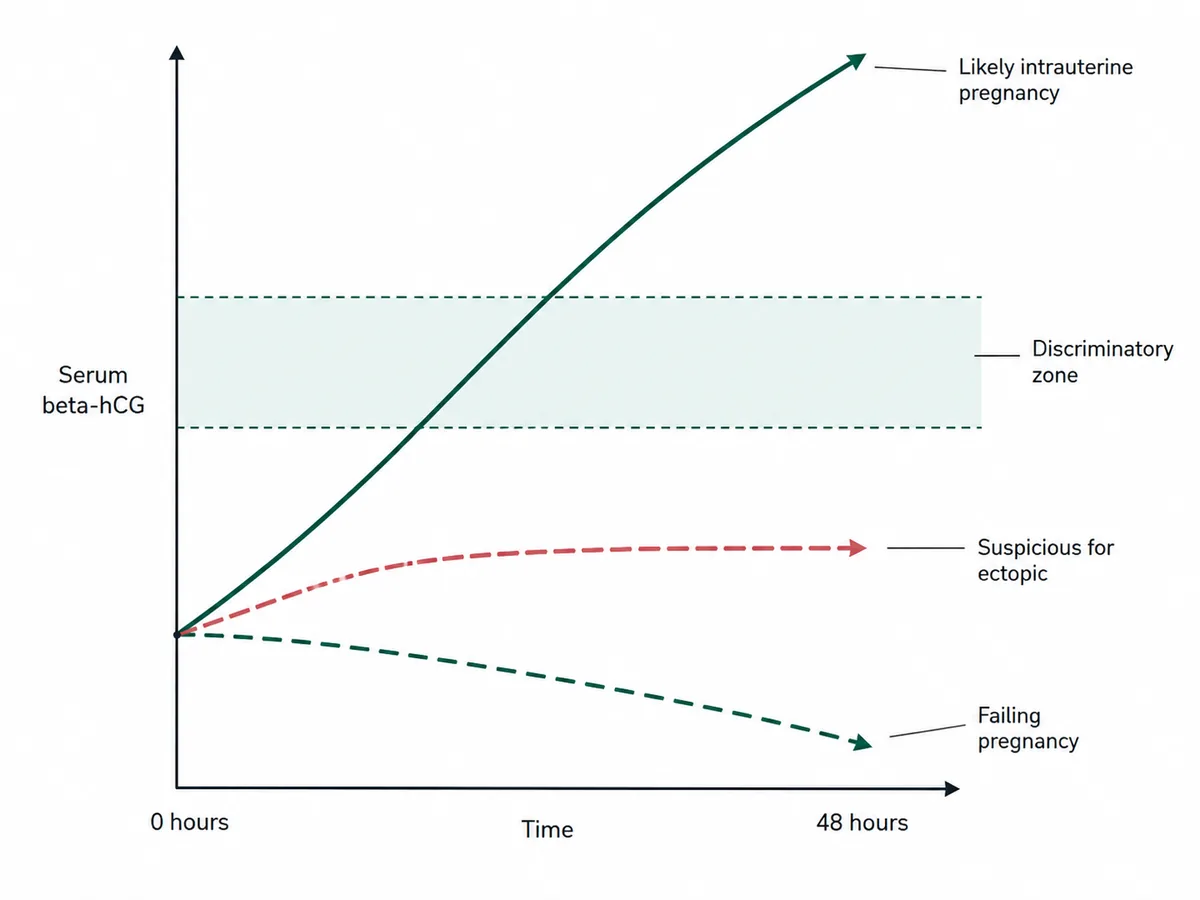 A graph of serum beta-hCG against time over forty-eight hours with three traces: a steep rise labelled likely intrauterine pregnancy, a shallow plateau labelled suspicious for ectopic, and a steep fall labelled failing pregnancy, with the discriminatory zone marked as a horizontal band